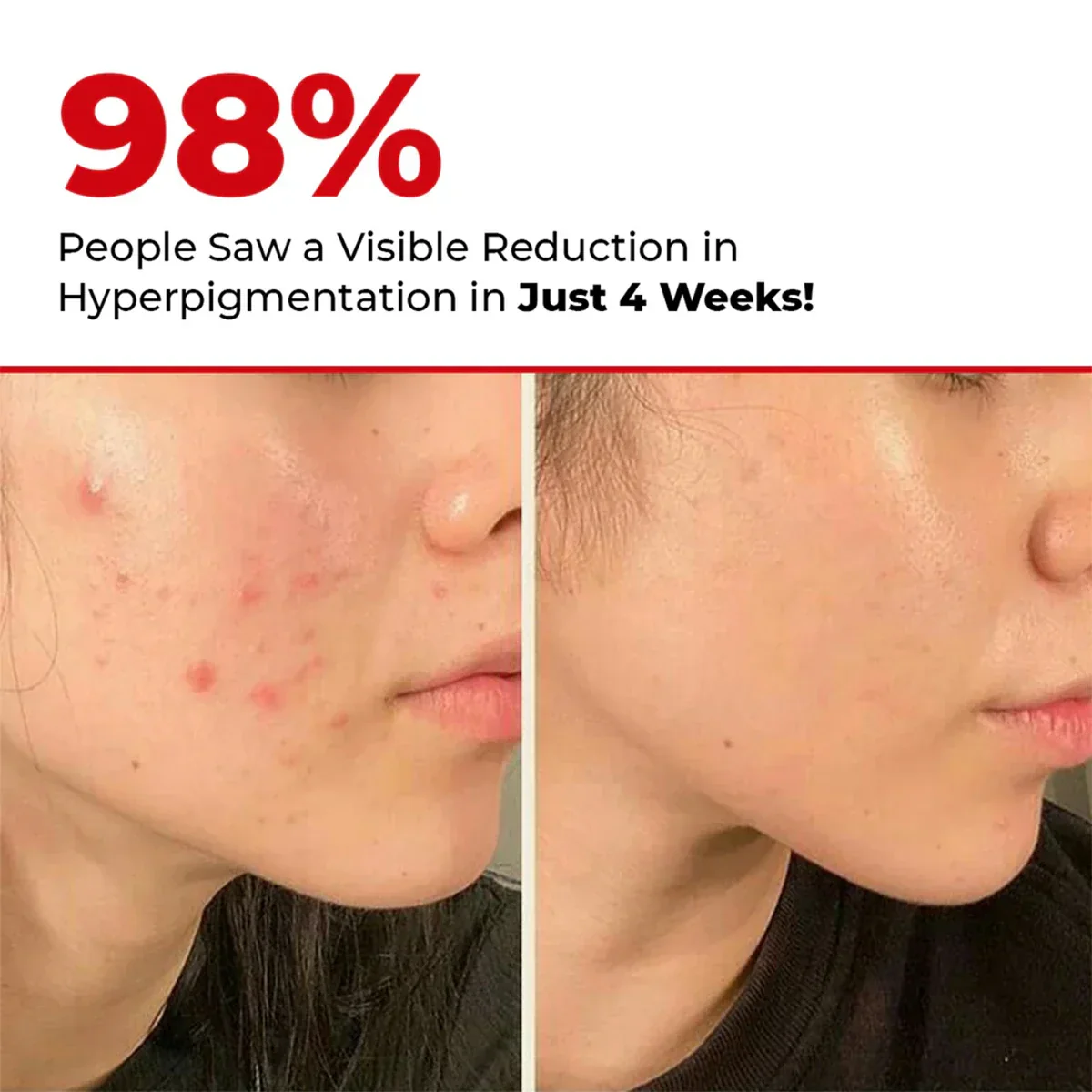 5 Antioxidant Serum Mini | 15 ML | Mini Sale - Image 2