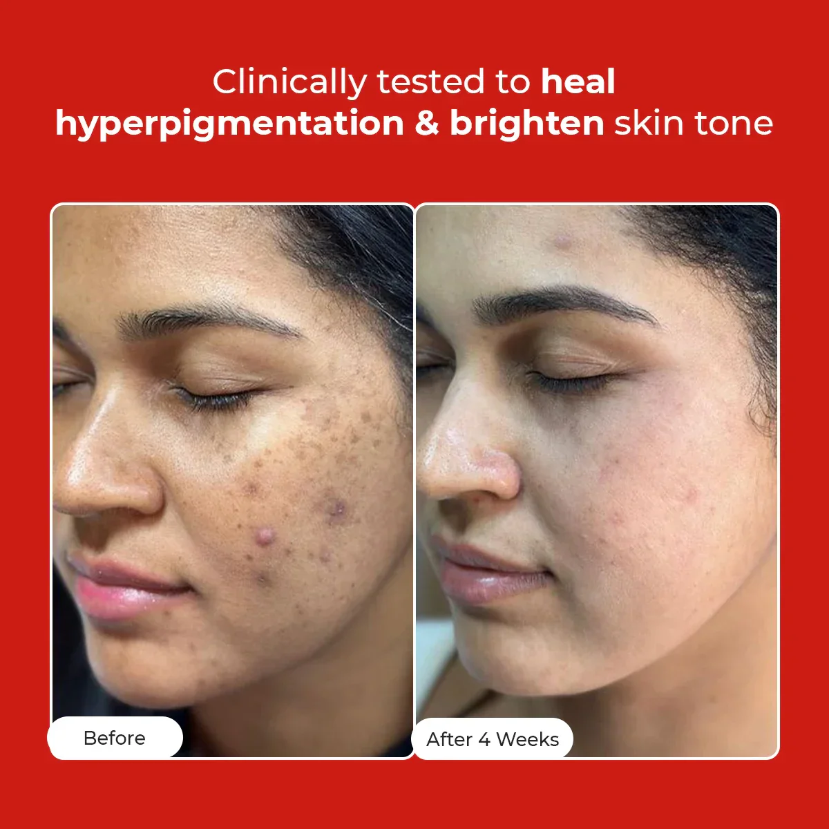 5 Antioxidant Skin Brightening Serum | 50 ml | HP - Image 2