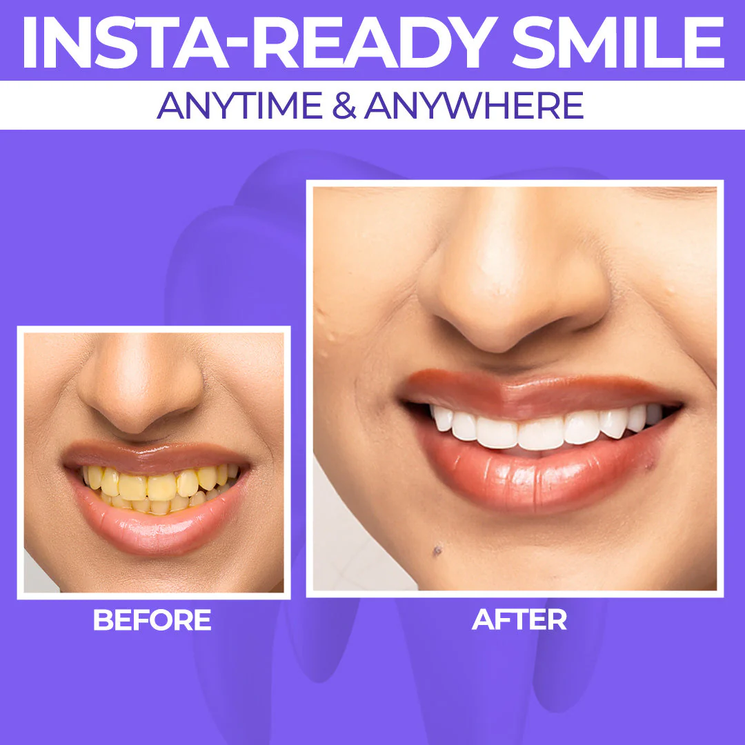 Advanced Instant Teeth Brightening Combo - Image 2