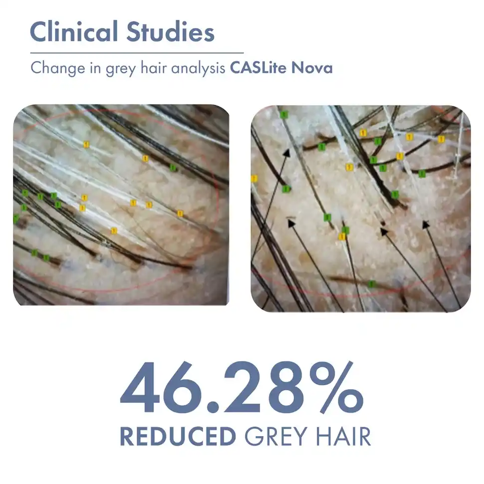 Anti-Grey Hair Prime Serum. - Image 5