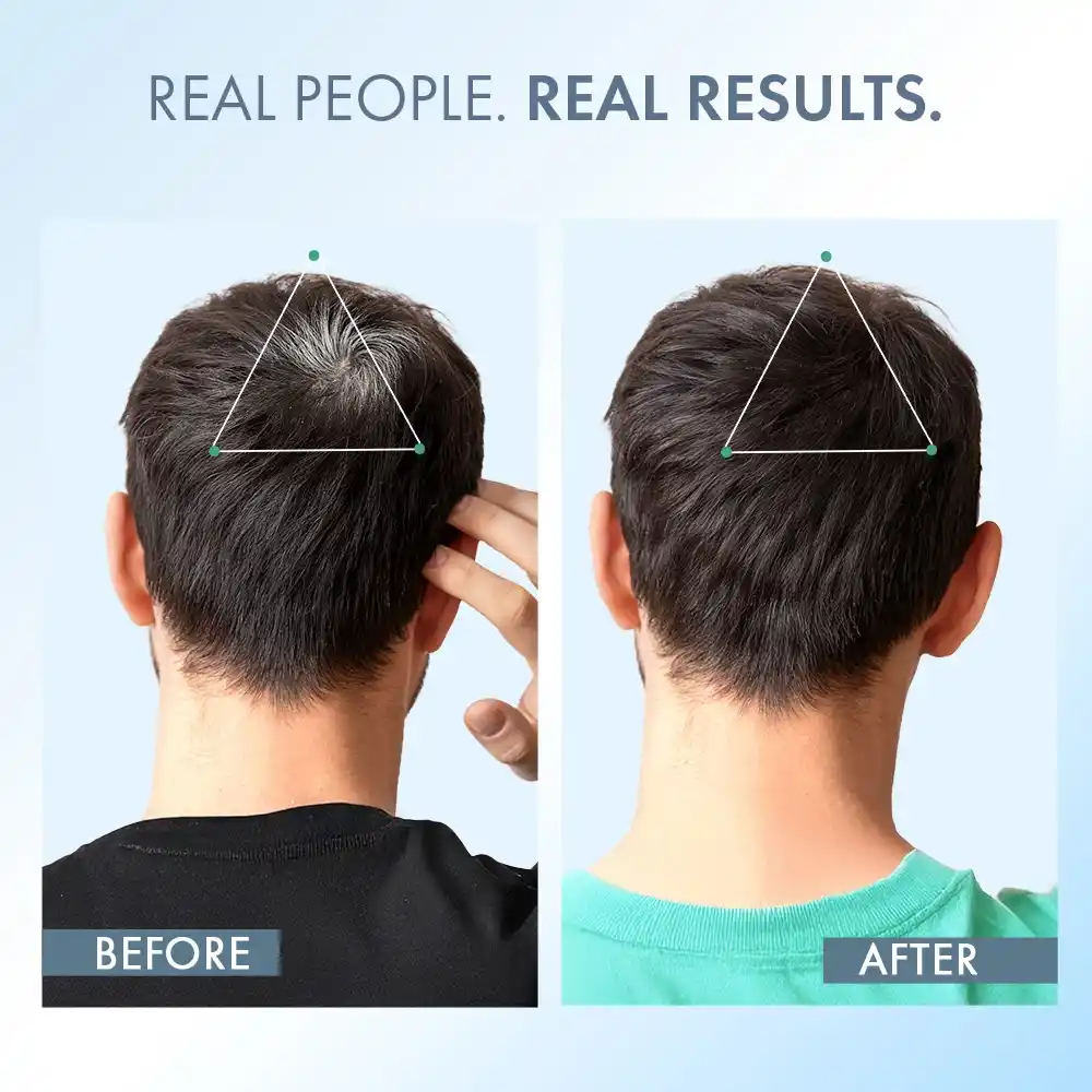 Anti-Grey Hair Prime Serum, 50 ml + Supplements 30N - Image 14