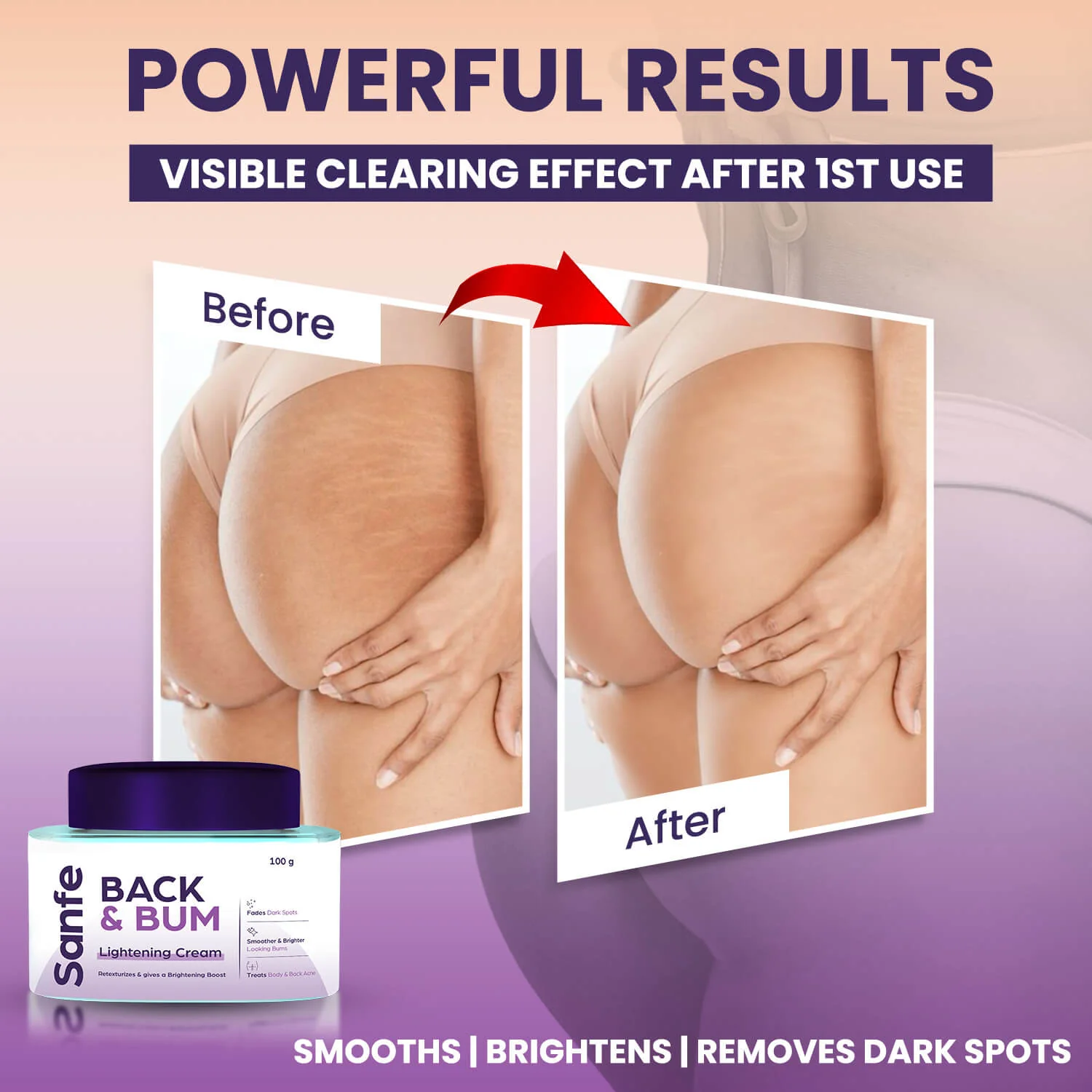 Back and Bum lightening Cream - 100gm - Image 4