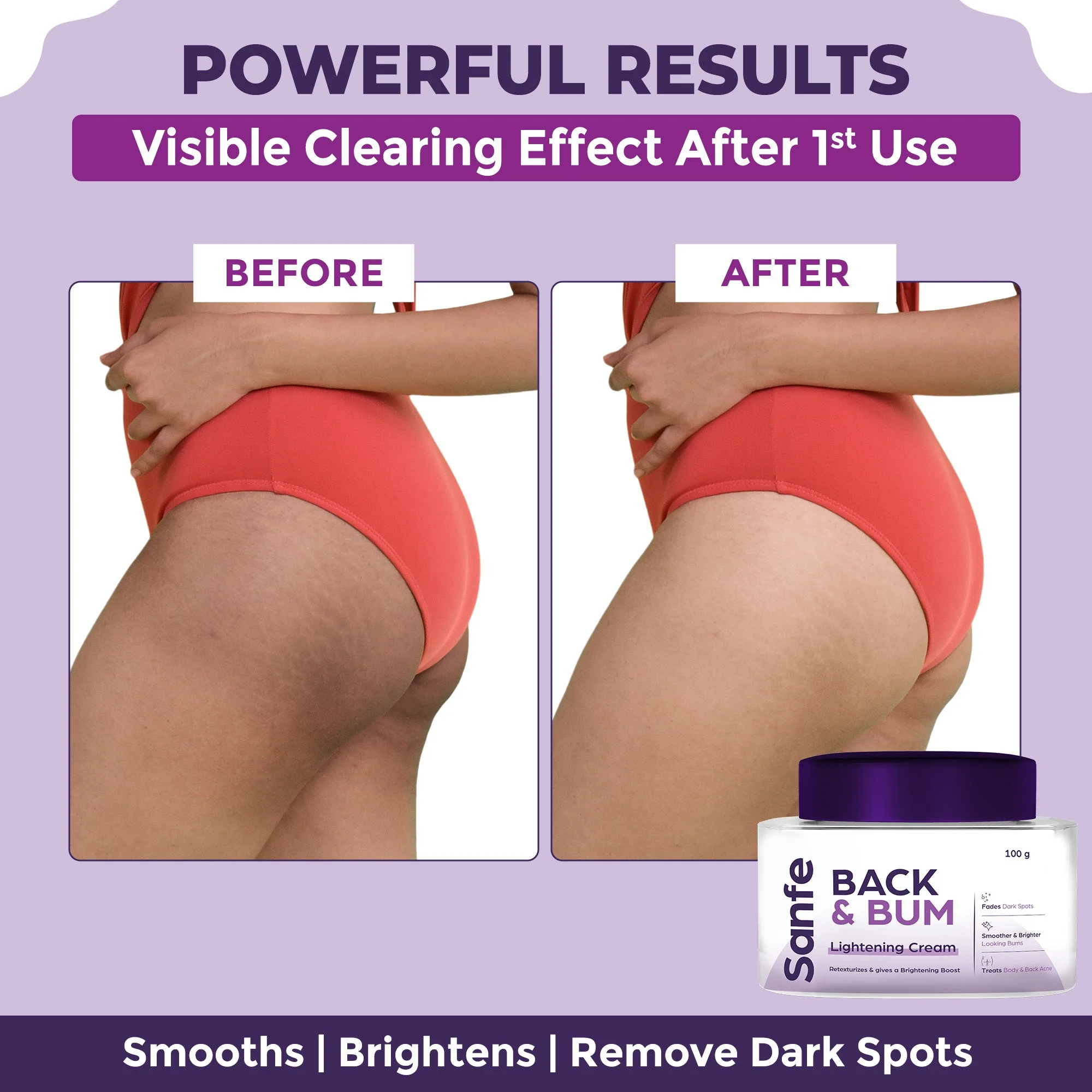 Back and Bum lightening Cream - 100gm - Image 2