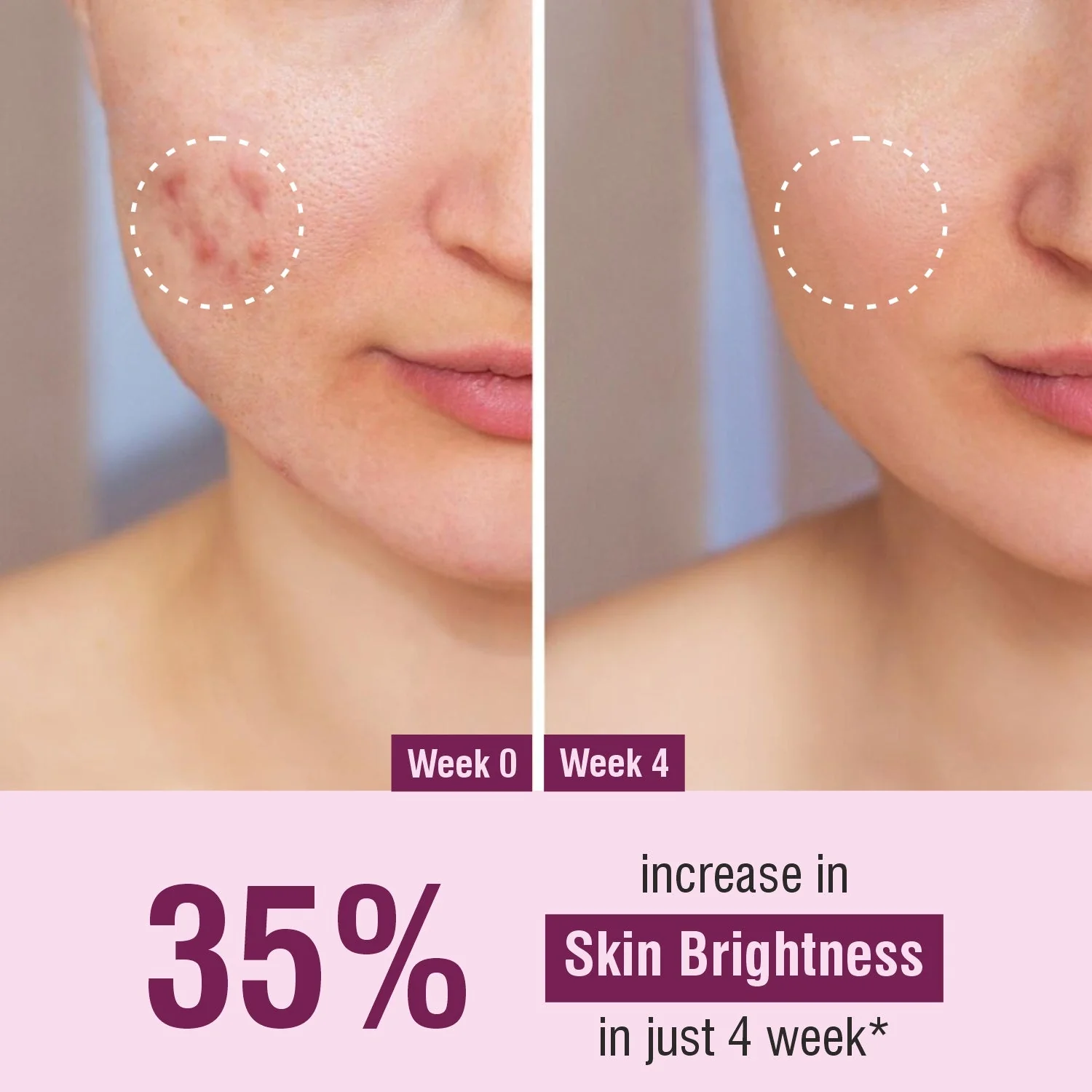 Bhoomi Herbal India Retinol + Niacinamide  Face Cream (50gm)- Pack of 2 - Image 4