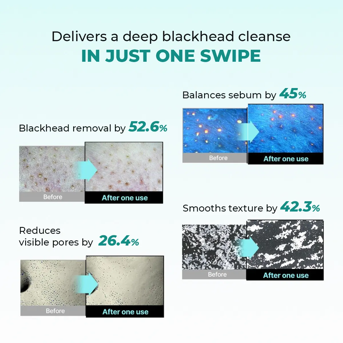 Blackhead Melting Water | 130 ml | Sale - Image 4
