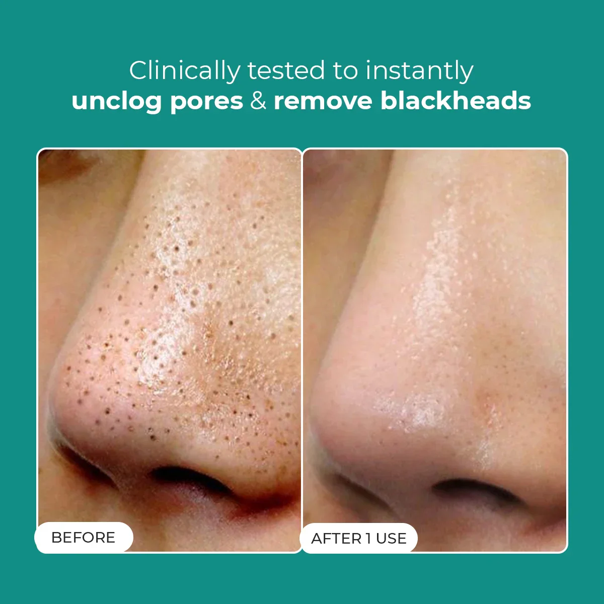 Blackhead Melting Water | BS - Image 2