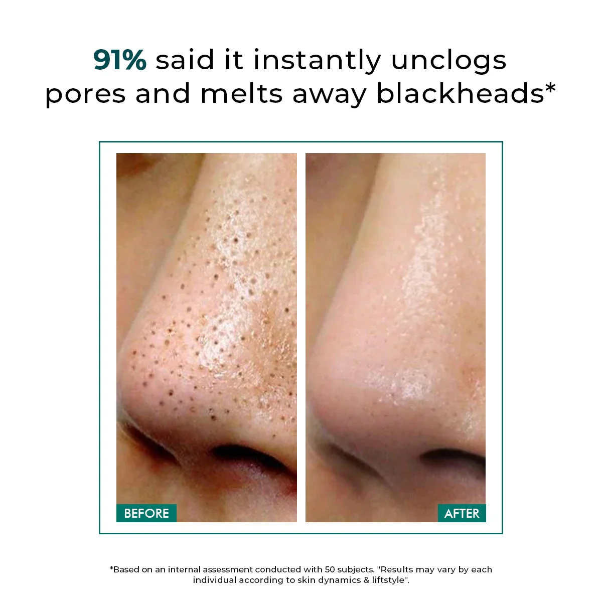 Blackhead Melting Water mini | 50 ml | Flash Sale - Image 8