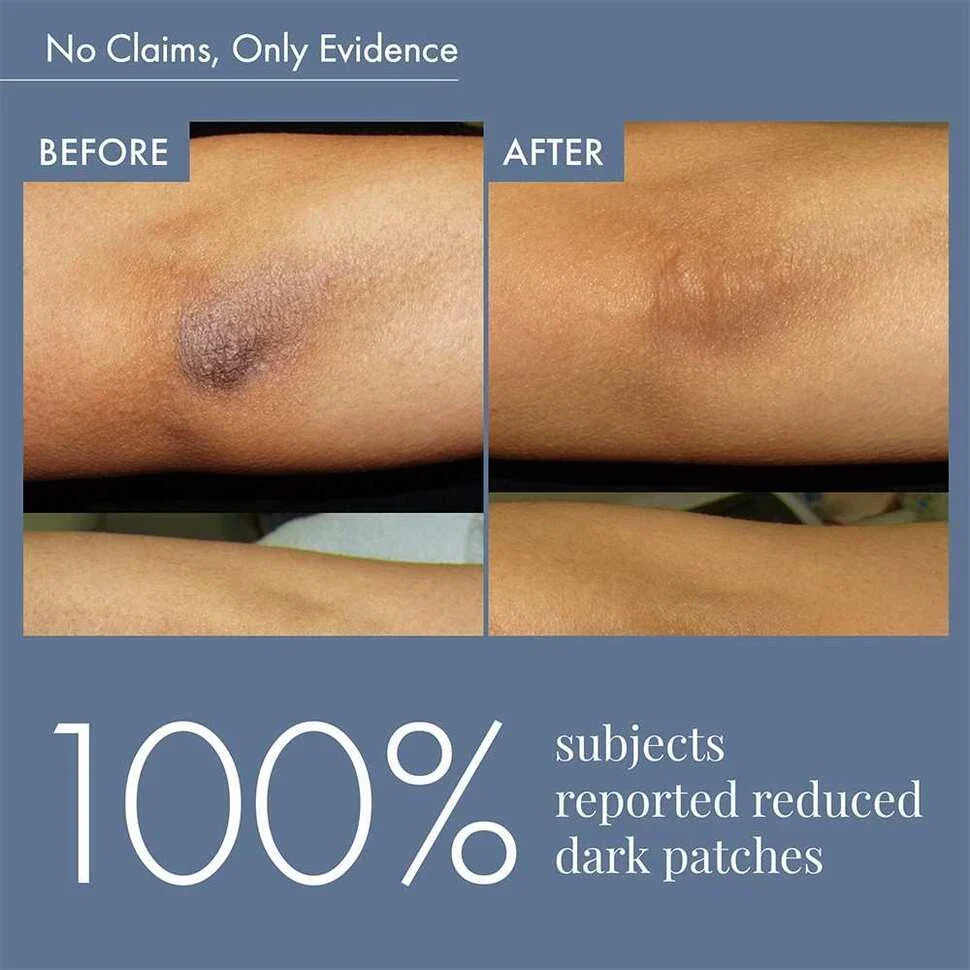 Dark Patches Corrector, 100ml - Image 5