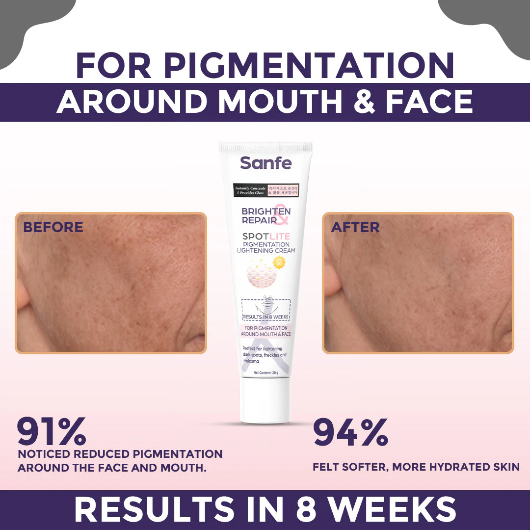 Dark Spot Corrector Cream | Face, Armpits, Hands, Knees | Rapid Tone Repair & Glow - Image 2