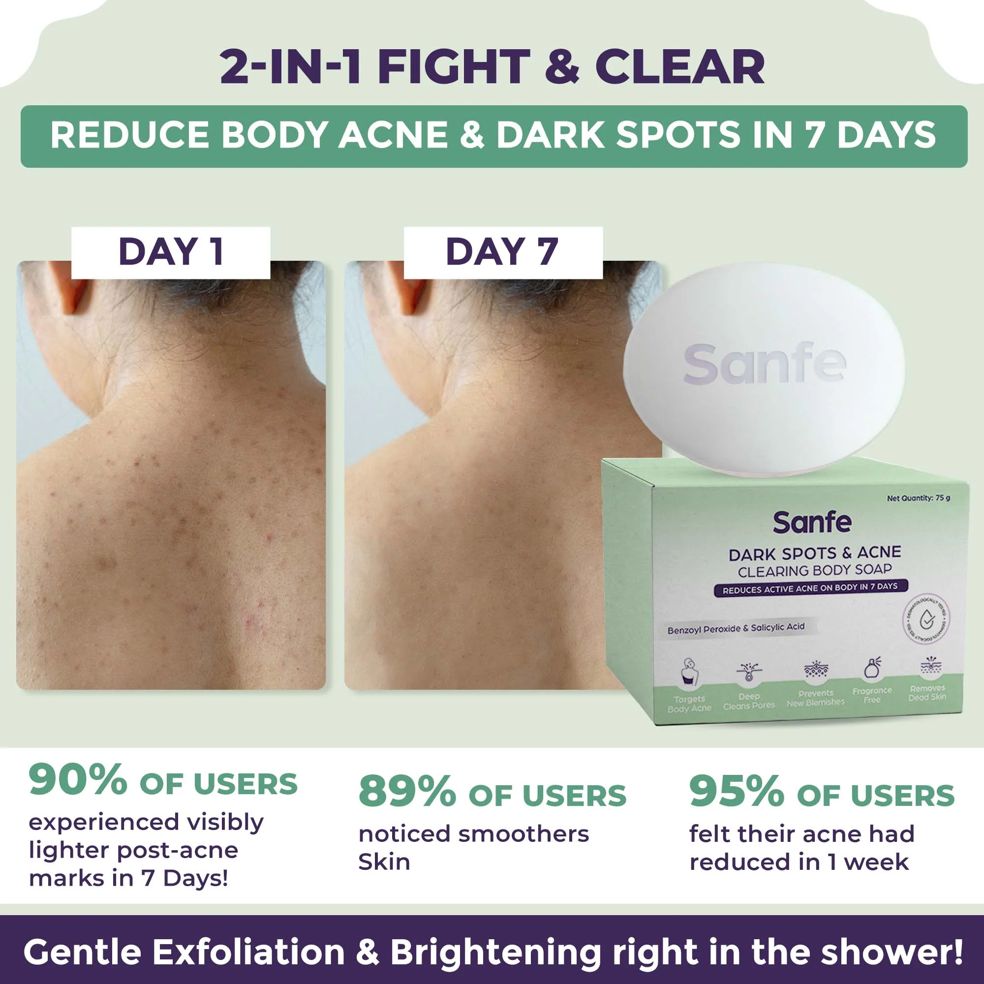 Dark Spots & Acne Clearing Body Soap – Pack of 4 - Image 4