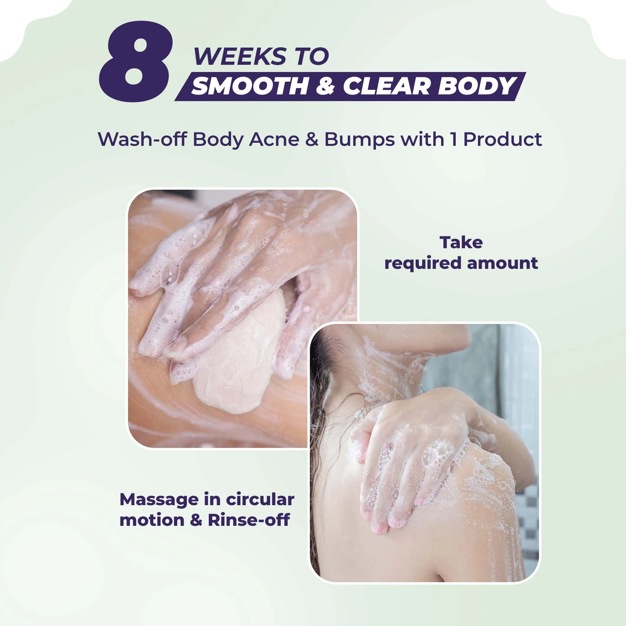 Dark Spots & Acne Clearing Body Soap – Pack of 4 - Image 8