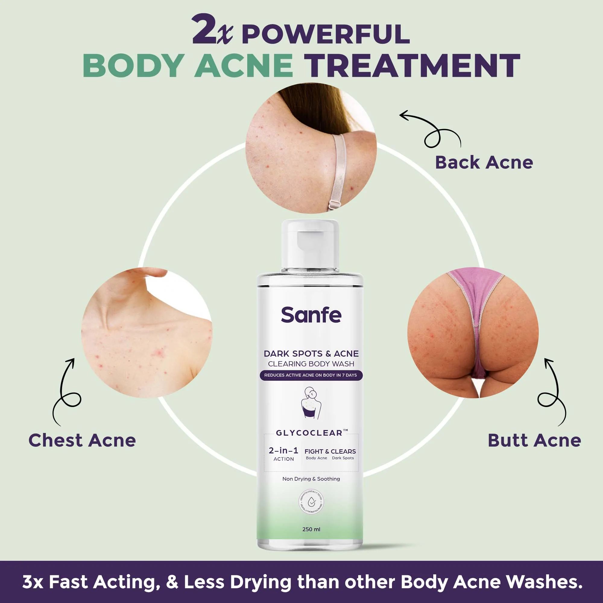 Dark Spots & Acne Clearing Body Wash (Pack of 2) - Image 4