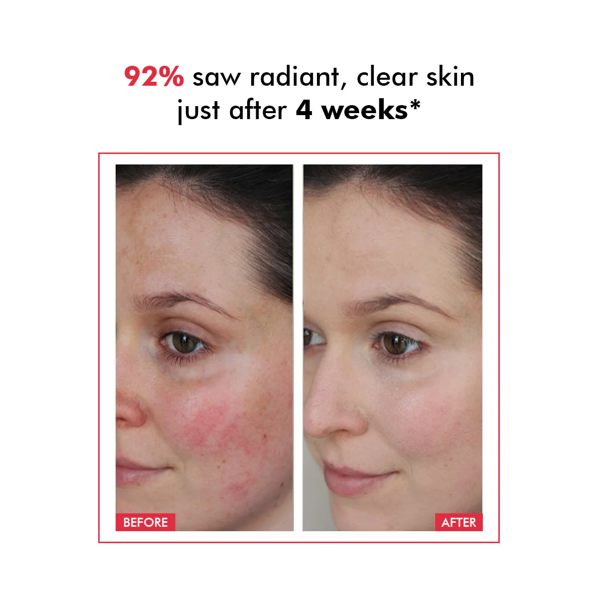 Derm Date Resurfacing Chemical Peel Treatment Serum | 30 ml | BS - Image 5