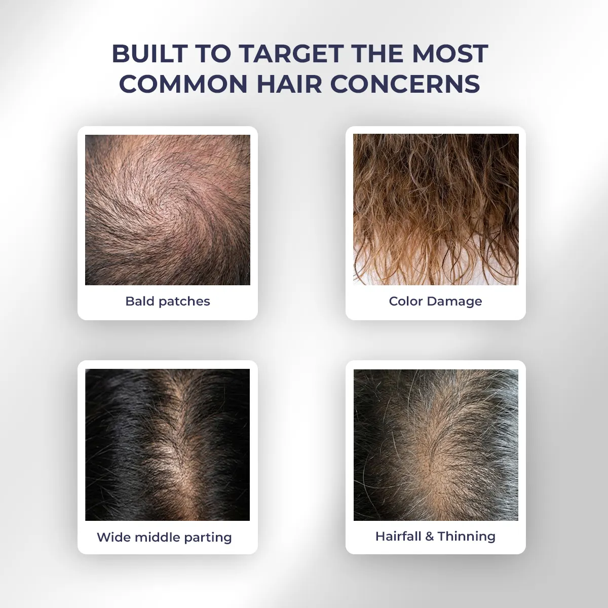 Hair Growth Duo | Shampoo & Serum | Reduces Hairfall & Supports New Hair Growth - Image 10