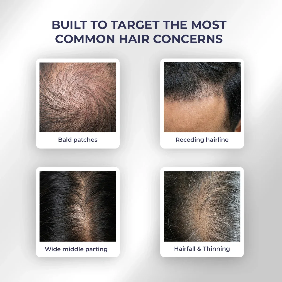 Hair Growth Serum | 30 ml - Image 10