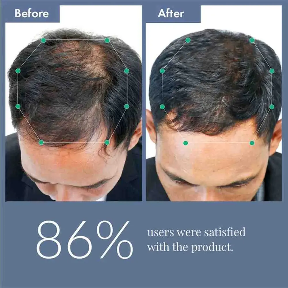 Hair Growth Serum, 50ml + Women's Hair Growth Supplement, 60N - Image 13
