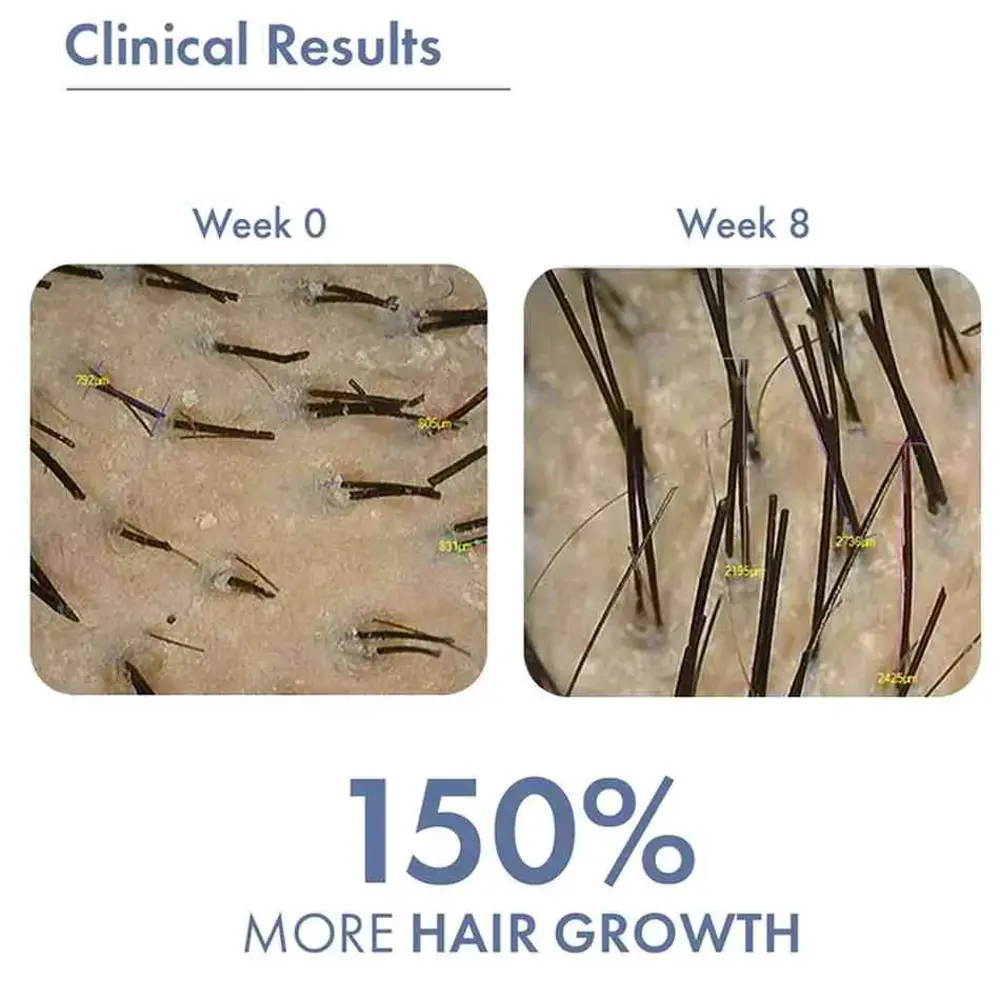 Hair Growth Serum, 50ml + Women's Hair Growth Supplement, 60N - Image 8