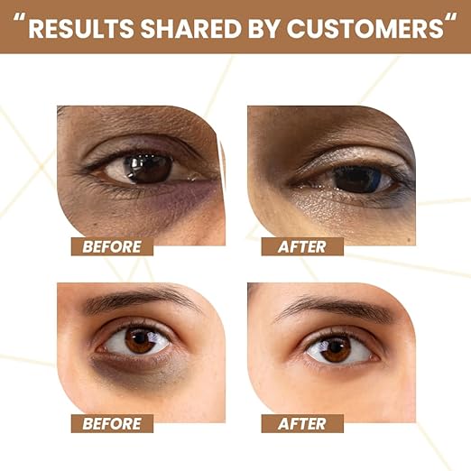 Hydrating Under Eye Repair Gel - 15 ml - Image 8