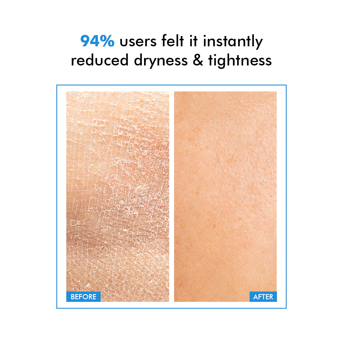 Hydro+ Hydrating & Plumping Serum | 1% Multi-Molecular Hyaluronic Acid | 30 ml | BS - Image 4