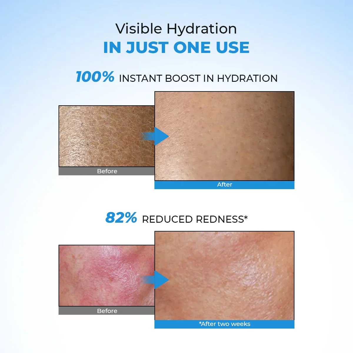 Hydro+ Multi Hyaluronic Acid Moisturiser (Pack Of 2) | 2x100 Gms - Image 4
