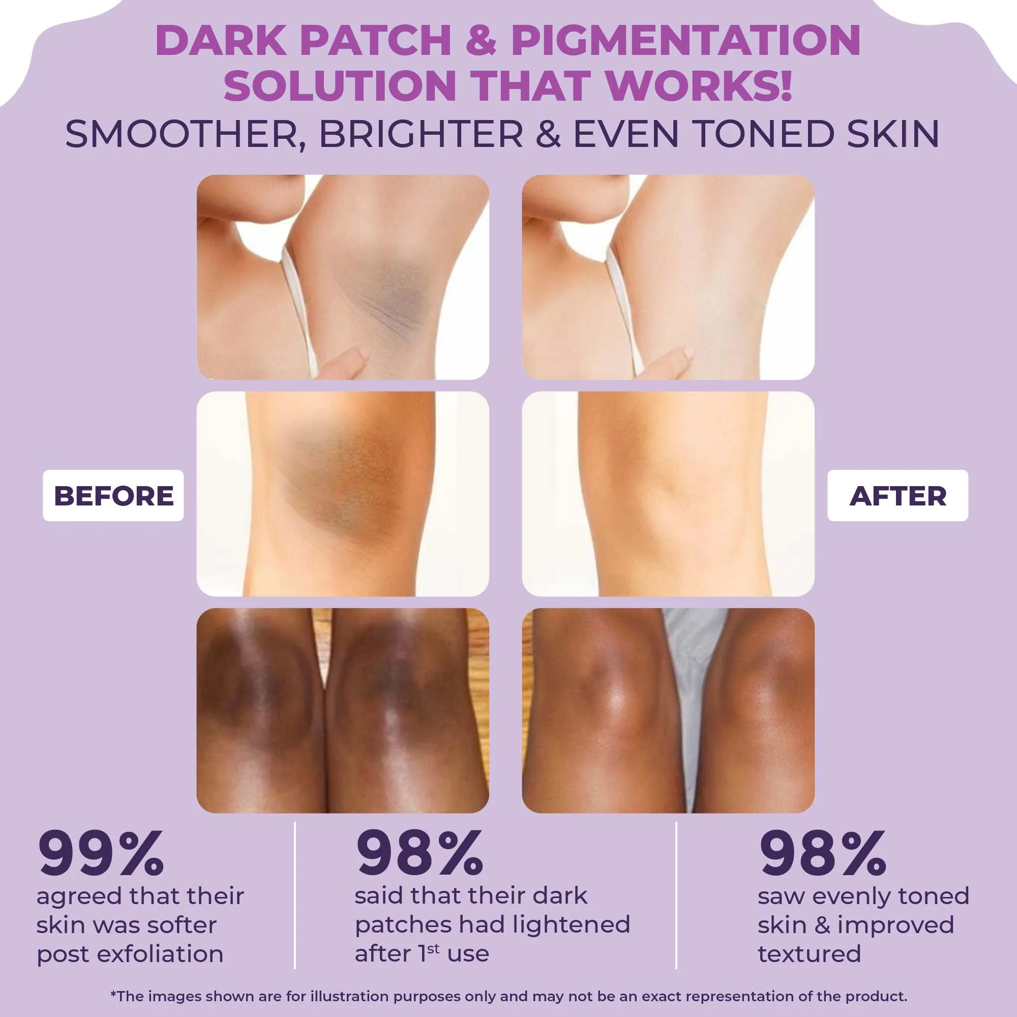 Instant Spotlite Mask For Dark Patches - Image 5