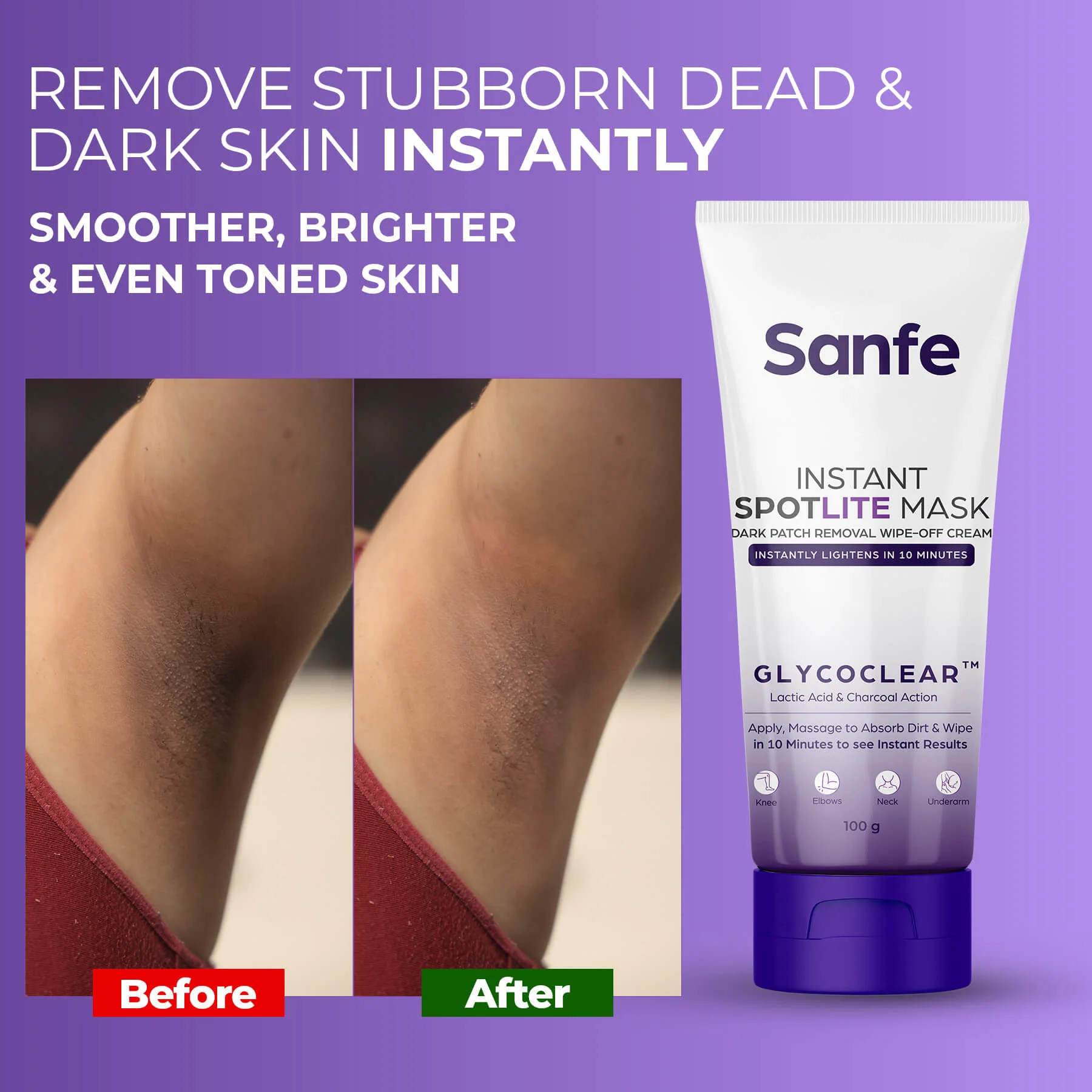Instant Spotlite Mask For Dark Patches (Pack of 2) - Image 3