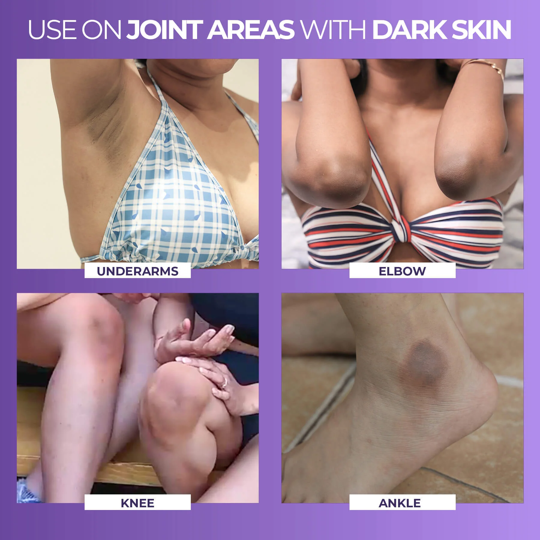 Instant Spotlite Mask For Dark Patches (Pack of 2) - Image 4