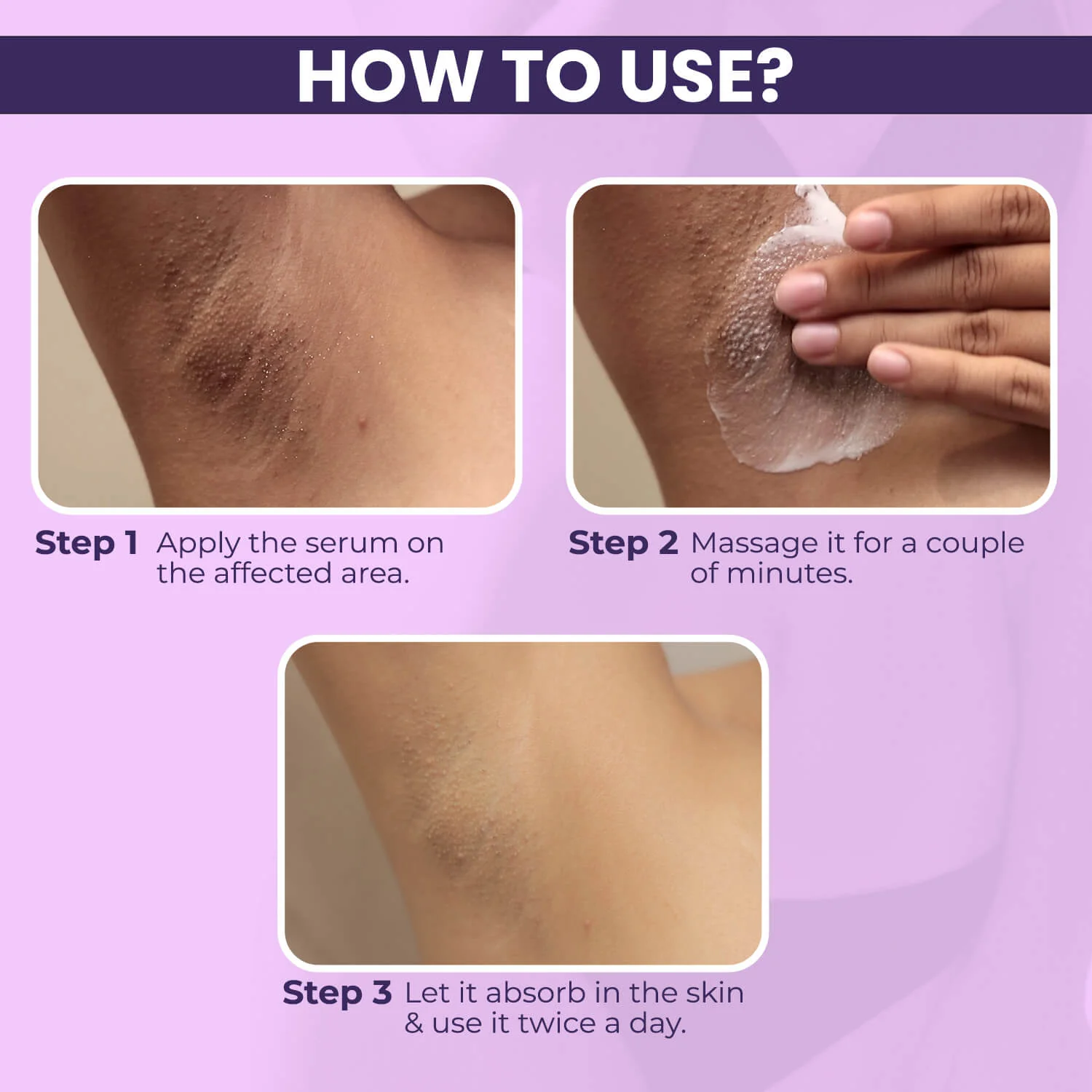 Intimate Lightening Serum 50gm (Pack of 3) - Image 8