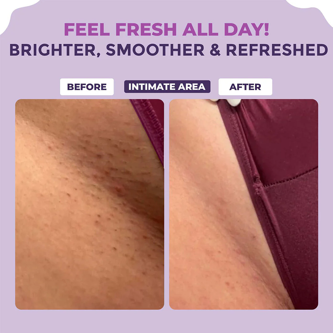 Lightening Serum - 50ml - Image 3