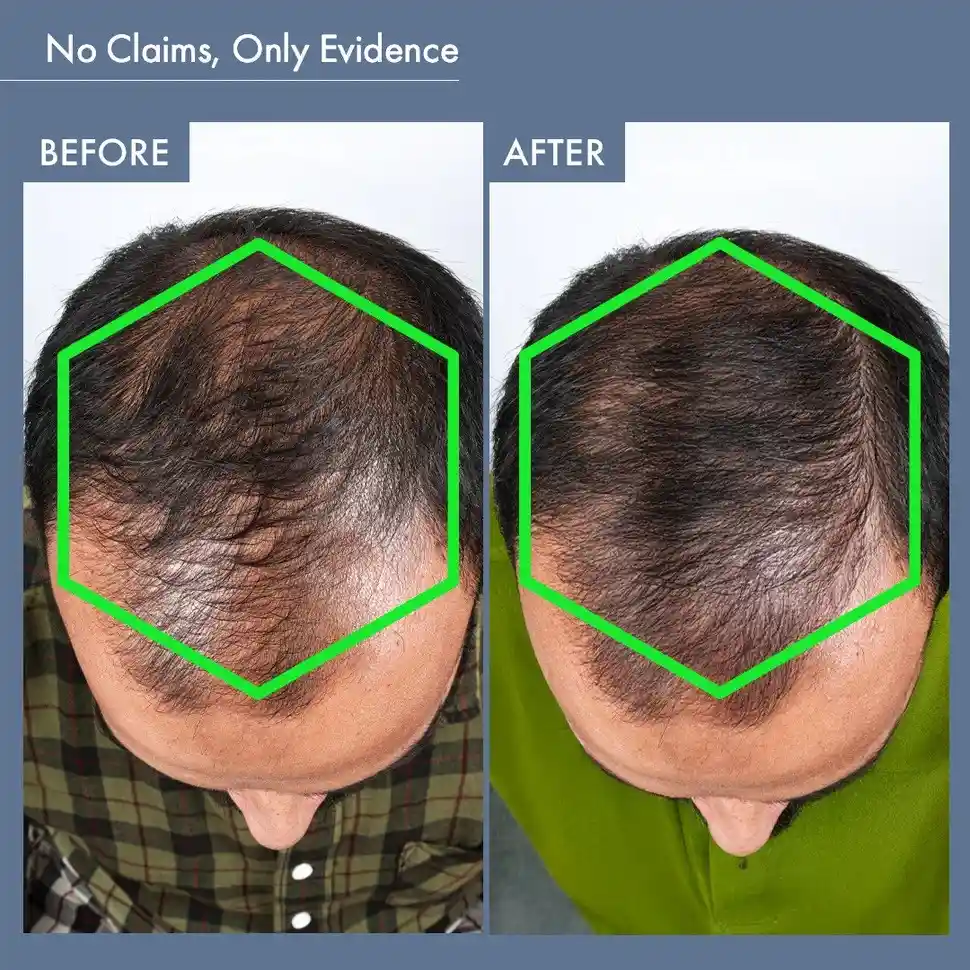 Men’s Hair Growth Solution - Image 9