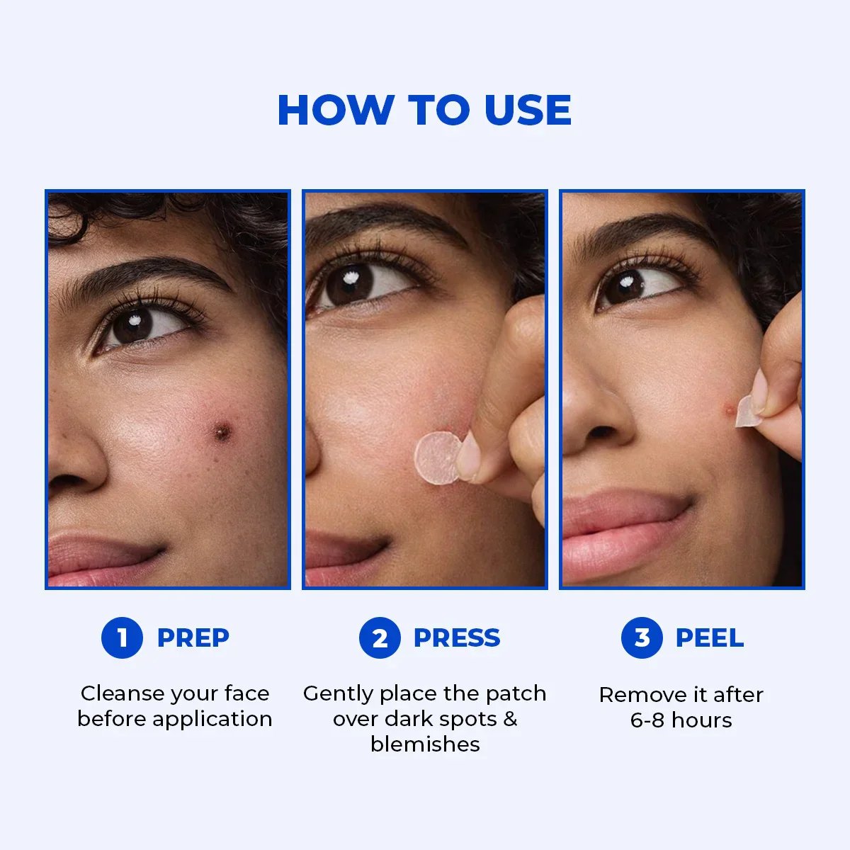Microneedle Patch For Dark Spot Removal | 4 Patches - Image 8