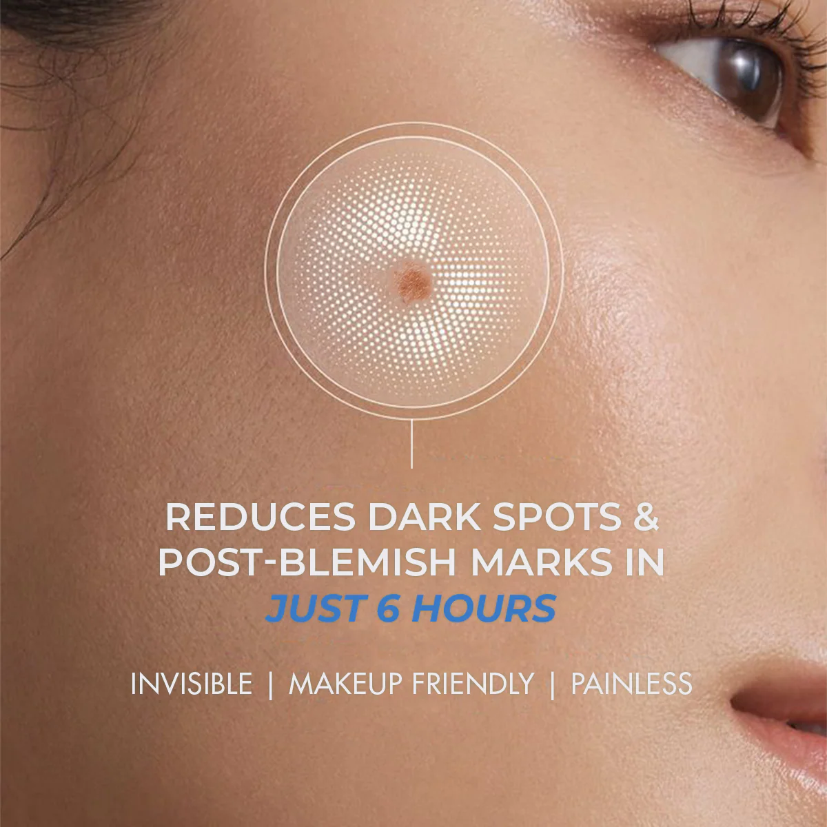 Microneedle Patch For Dark Spot Removal | 4 Patches | BS - Image 2