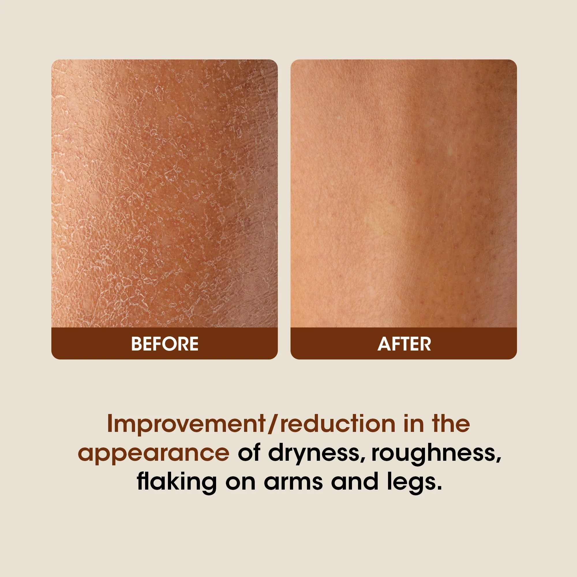 OG BEAUTY SCIENCE+ AHA BHA Body Lotion, Hydrating, Non-Greasy, Smooth & Radiant Skin, Shea & Cocoa Butter, 350ml - Image 5