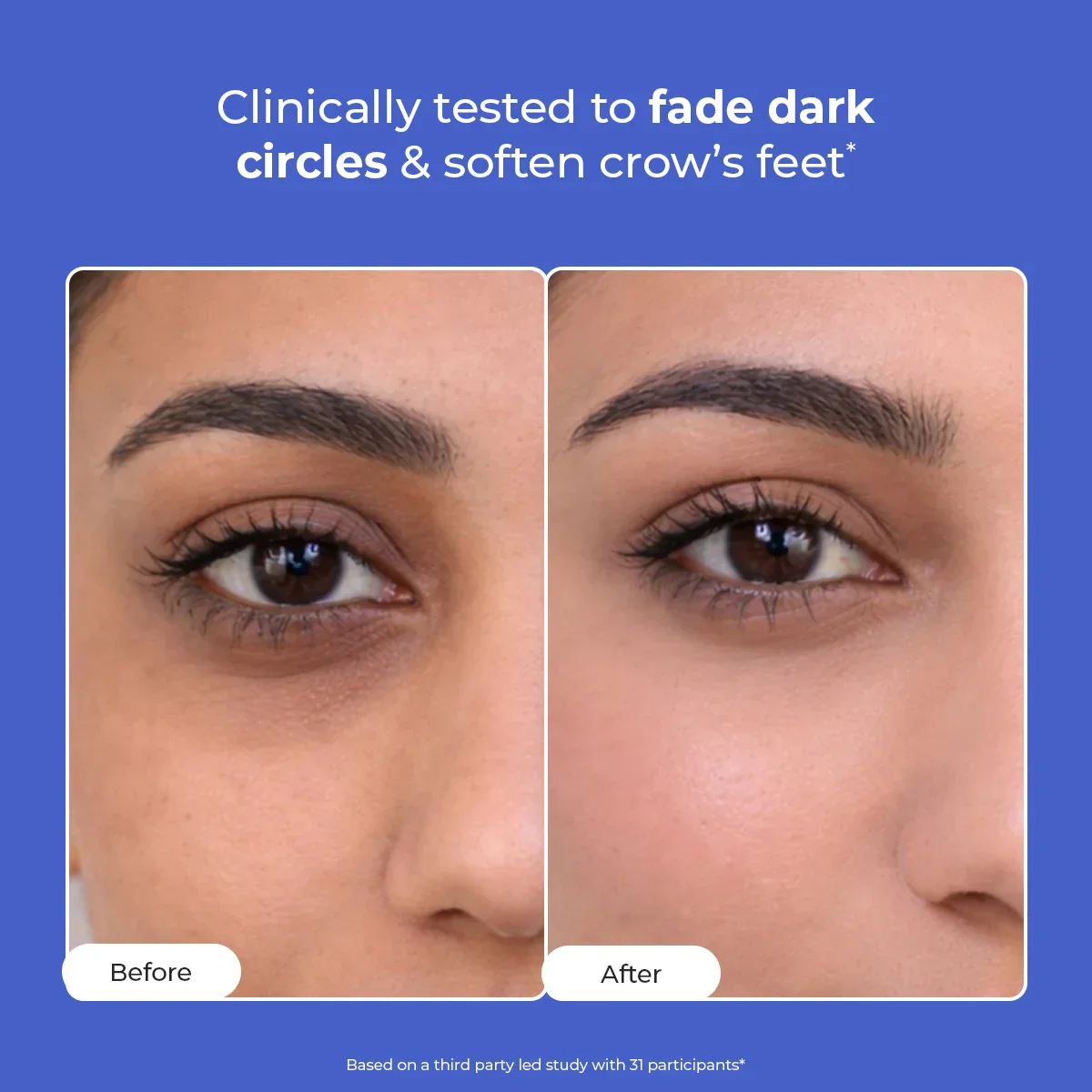Retinol Peptide Eye Treatment Serum | 15 ml | Sale - Image 2