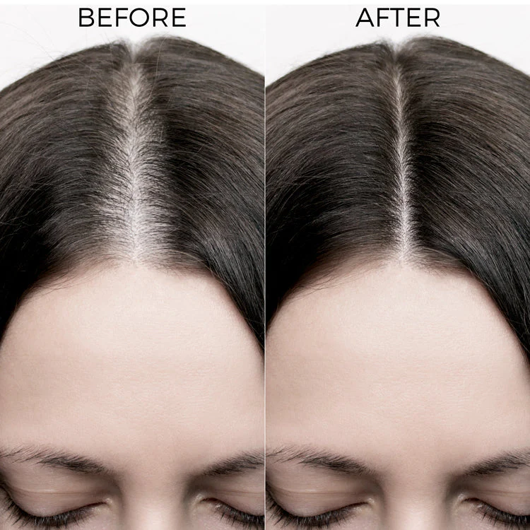 Rosemary Oil Shots For Visible Hair Growth - Image 4