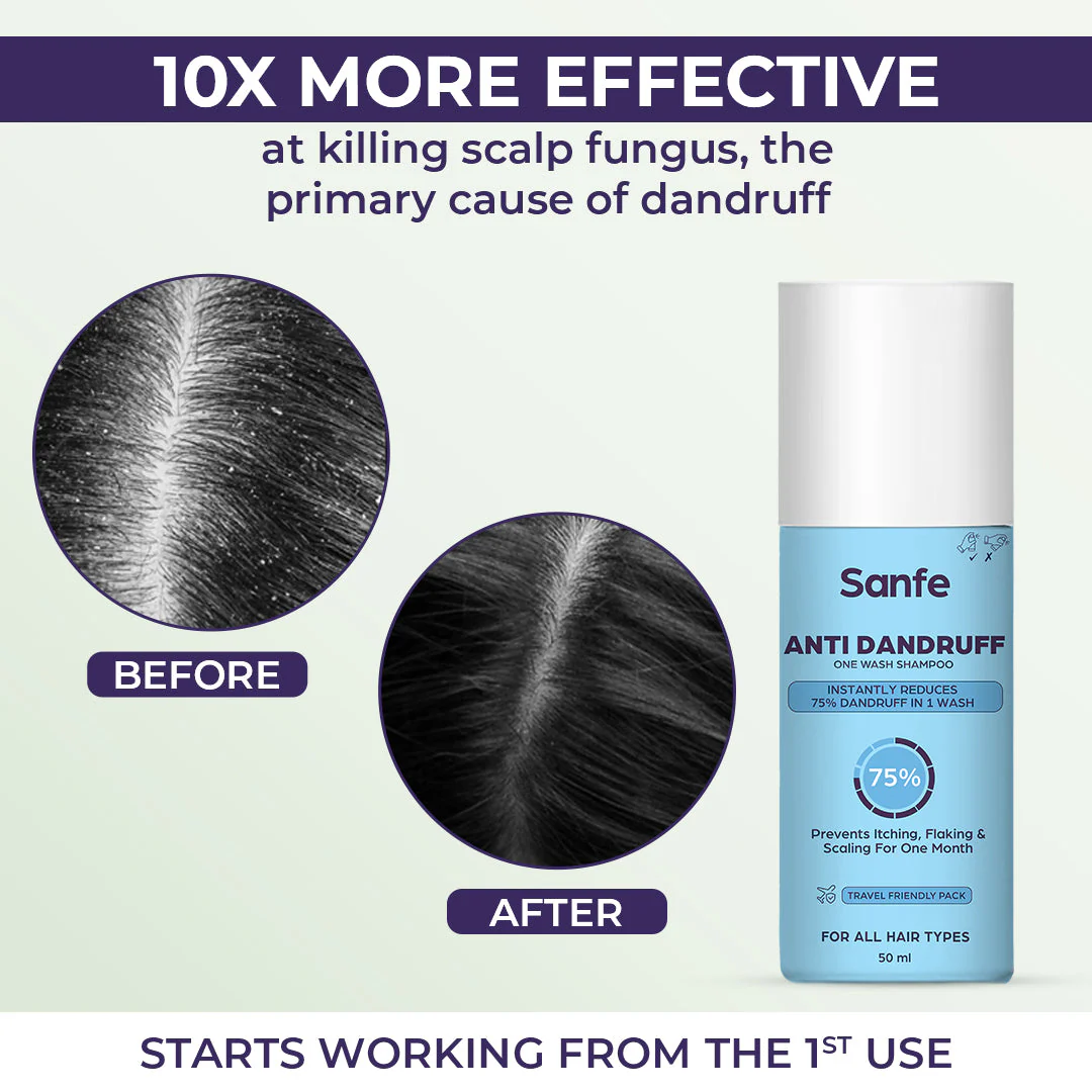 Sanfe Anti Dandruff One Wash Shampoo Removes Dandruff, Helps With Itching & Irritation 50ml - Pack of 3 - Image 3