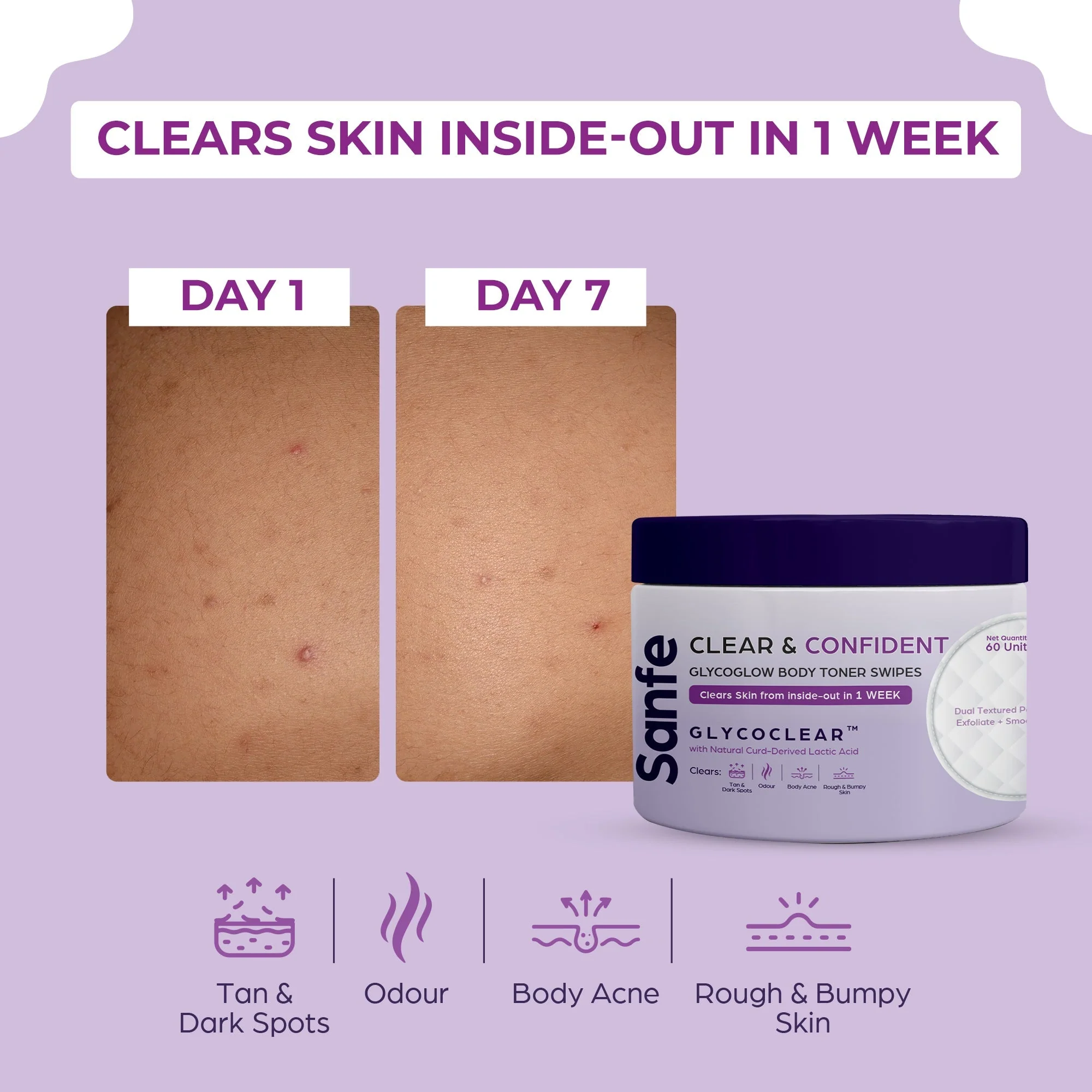 Sanfe Body Toner Wipes | 60 units | Acne, Tanning, KP, Dark Spots, Bumps | Rs.10/use | For Indian Skin - Image 2