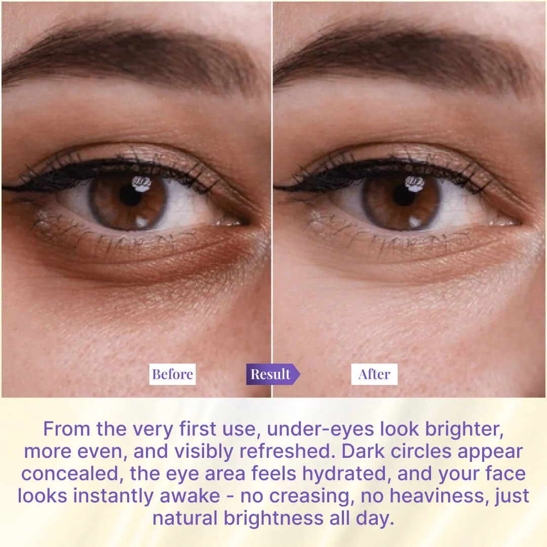 Sanfe Brighten & Conceal Undereye Cream | For dark Circles, wrinkles & Puffiness - 20g - Image 4