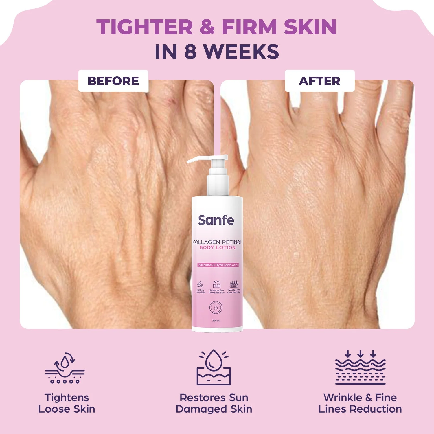 Sanfe Collagen Retinol Body Lotion - 200ml - Image 2