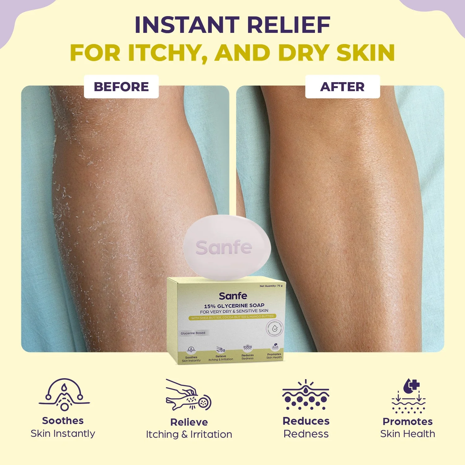 Sanfe Eczema Soap - 75gm - Image 4