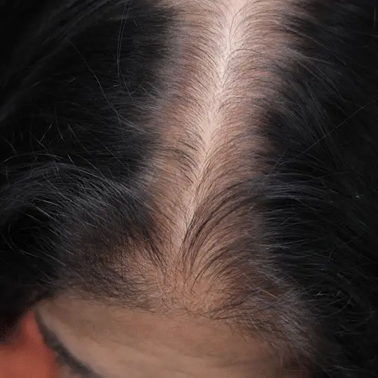 Sanfe Hairline & Gray Concealer Touch Up Powder - Image 2