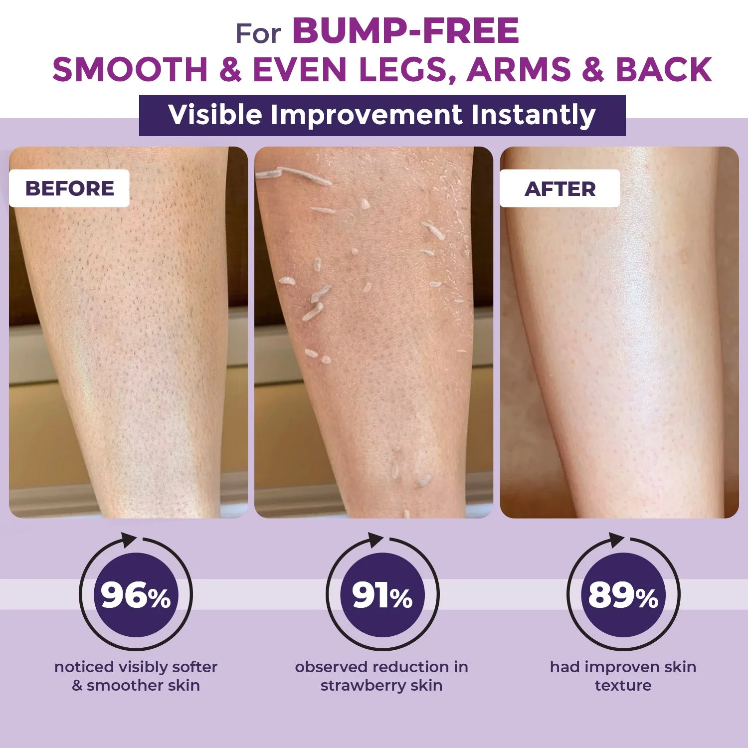 Sanfe Instant Bumps Eraser Exfoliating Gel - Image 2