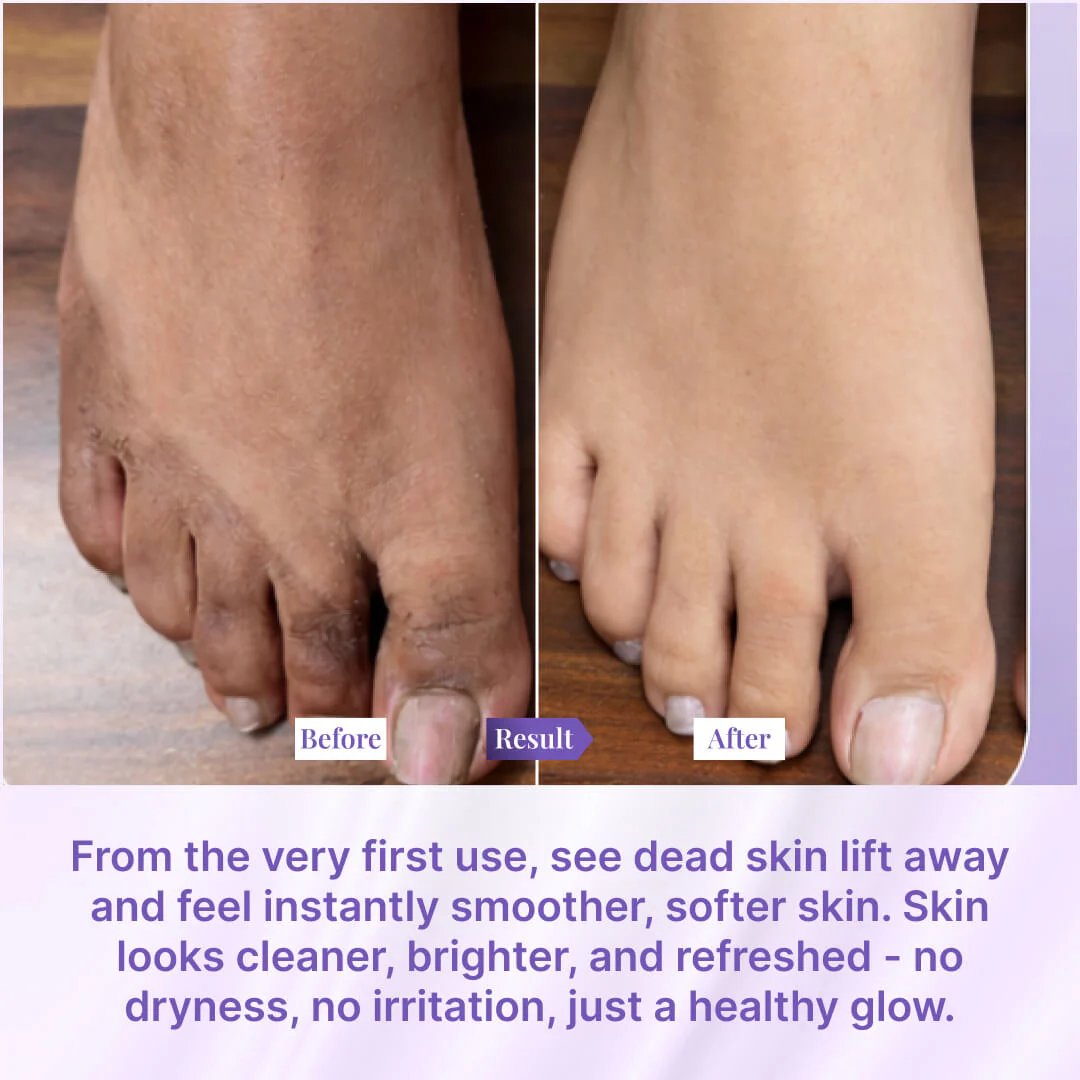 Sanfe Instant Dead Skin Removal Exfoliating Mousse - 60ml (Pack of 3) - Image 5