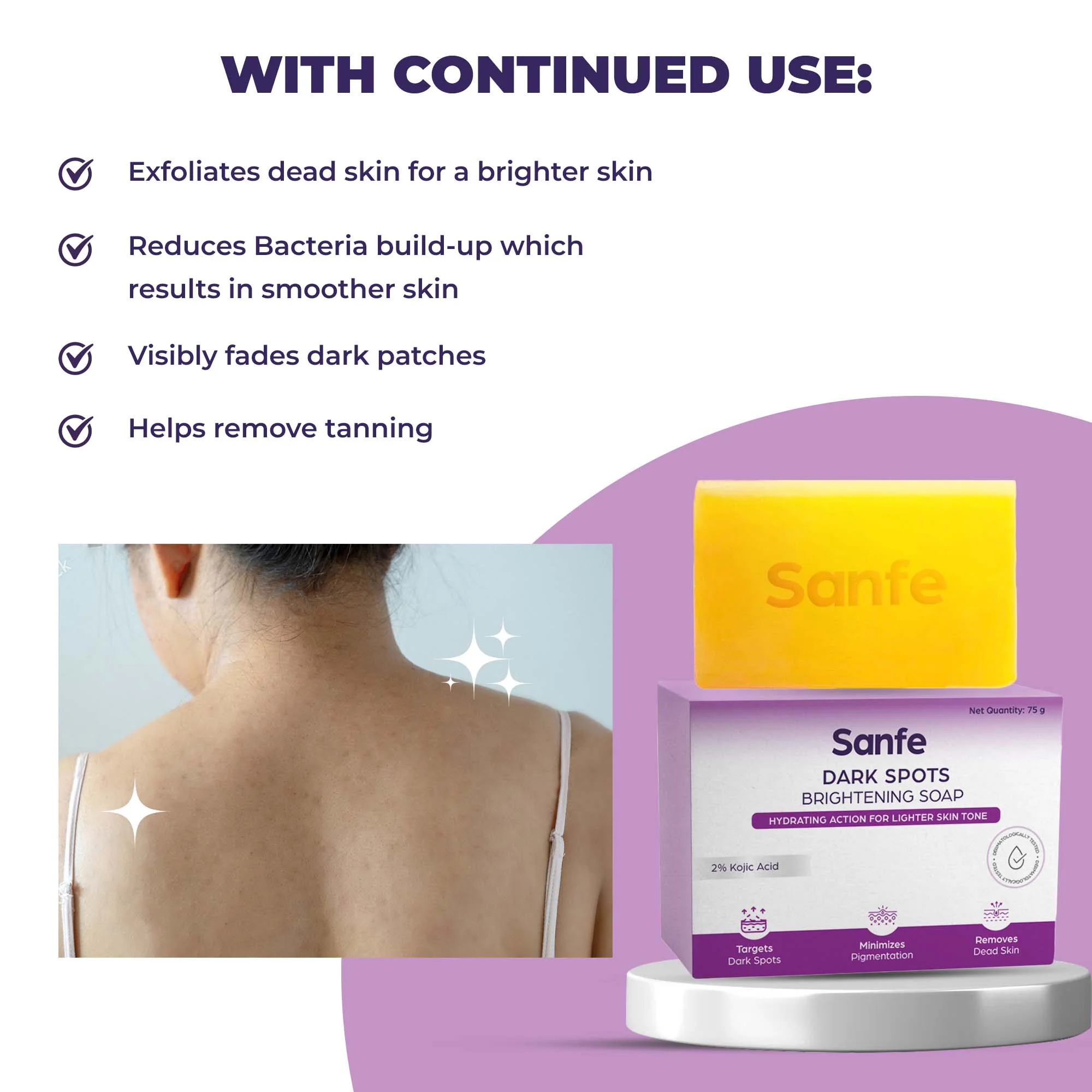 Sanfe Kojic Acid Soap for Dark Spots & Pigmentation - Image 3
