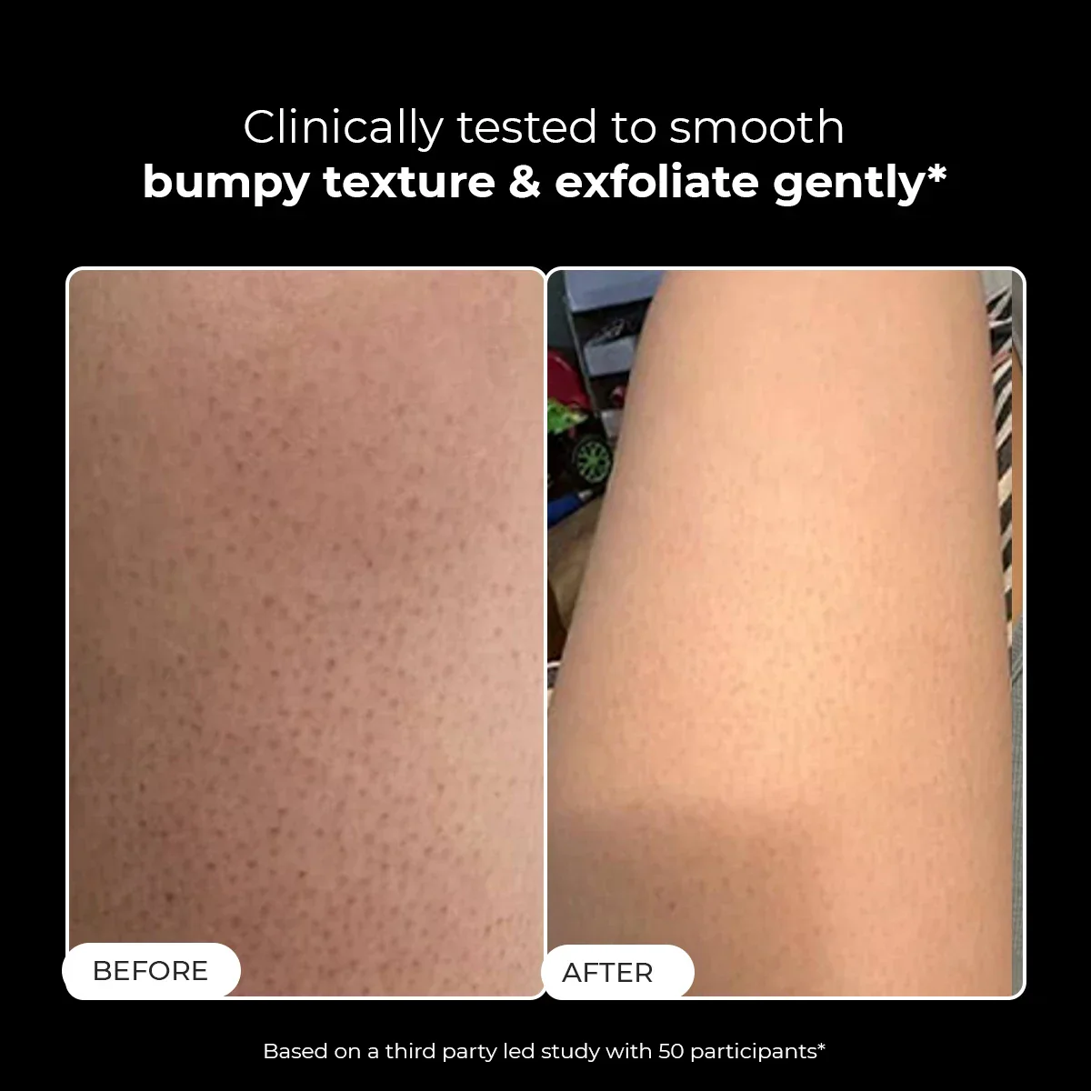 Skin Reset Exfoliating Bodywash | 300 ml | BS - Image 2