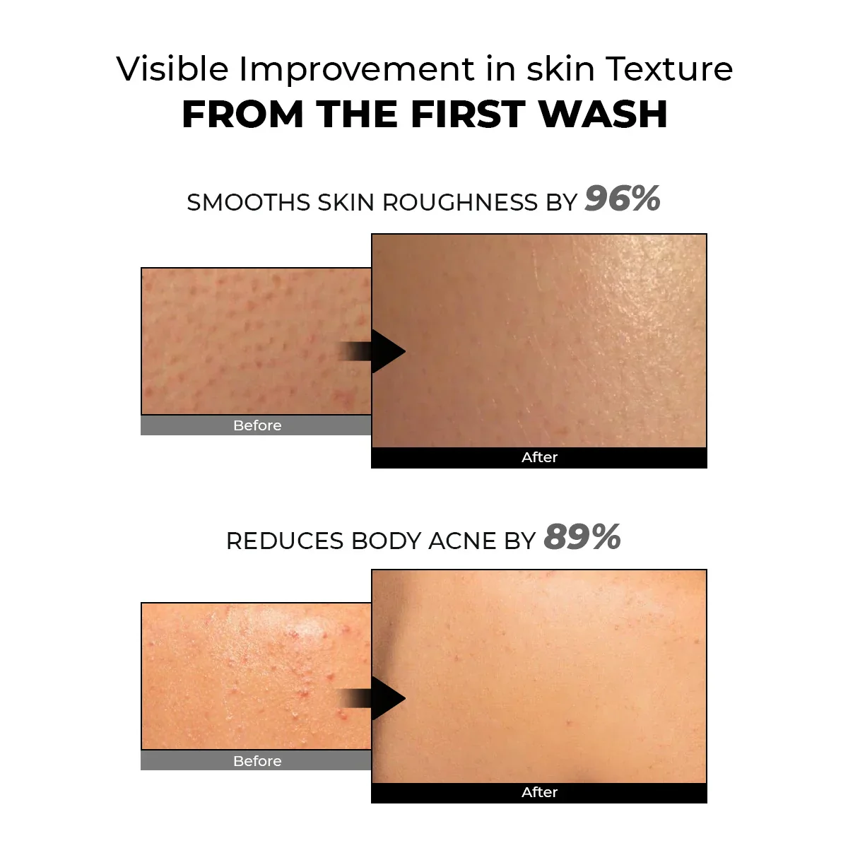 Skin Reset Exfoliating Bodywash | 300 ml | Flash Sale - Image 4