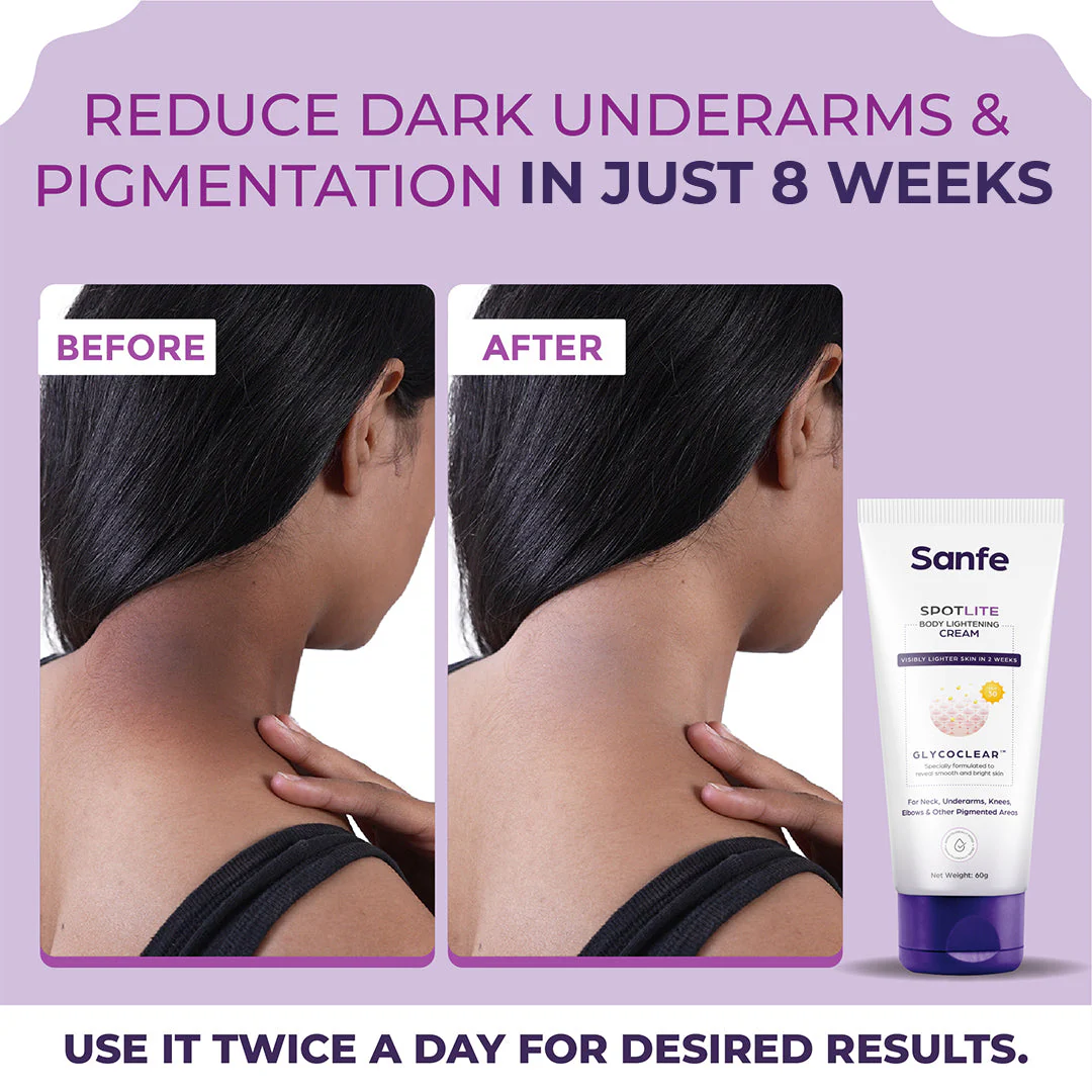 Spotlite Body Lightening Cream - Pack of 2 - Image 2
