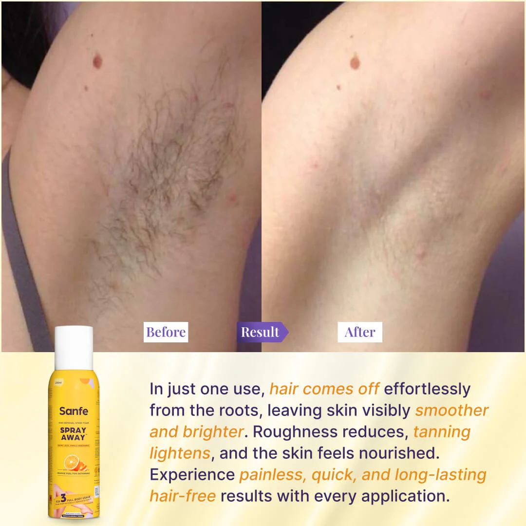 Spray Away Hair Removal Spray - 200ml - Image 5
