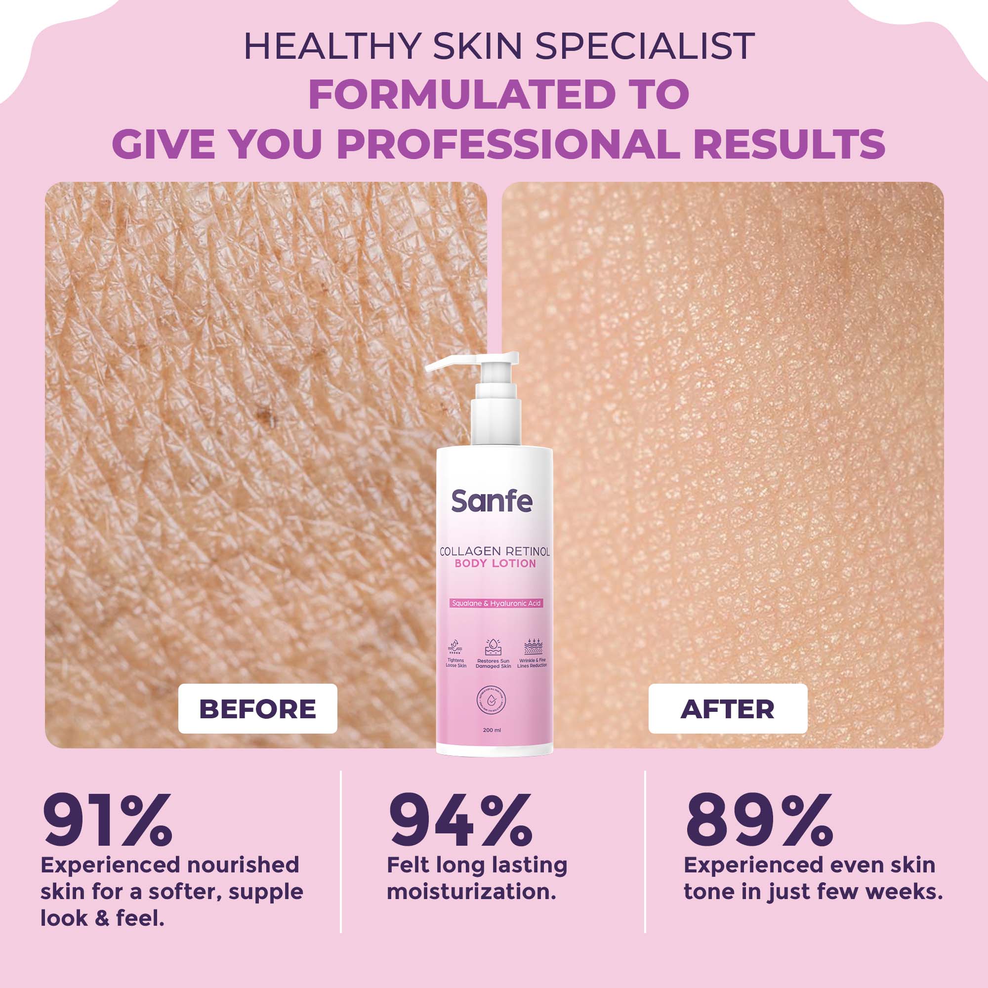 Stretch Mark Removal Combo - Image 5