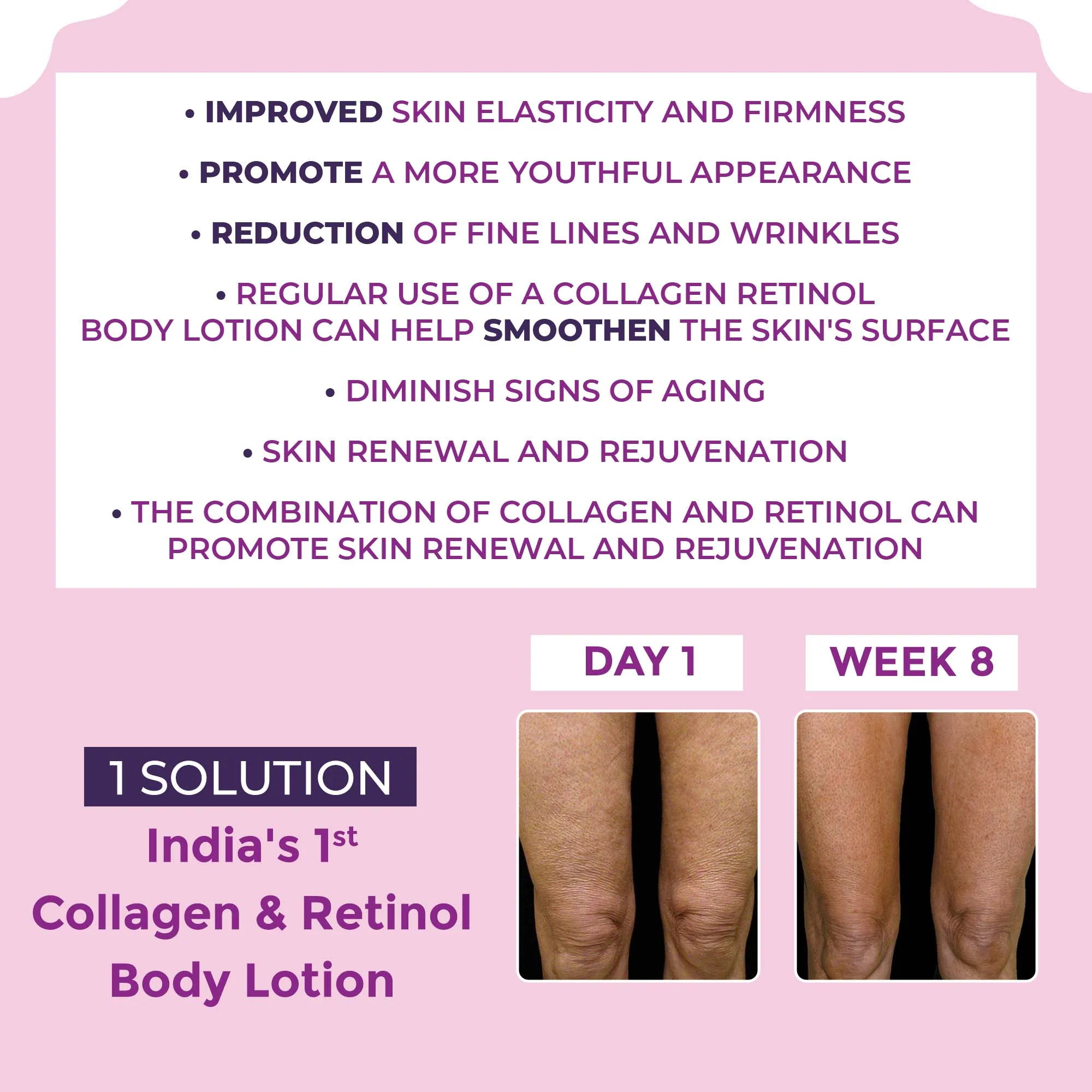 Stretch Mark Removal Combo - Image 6